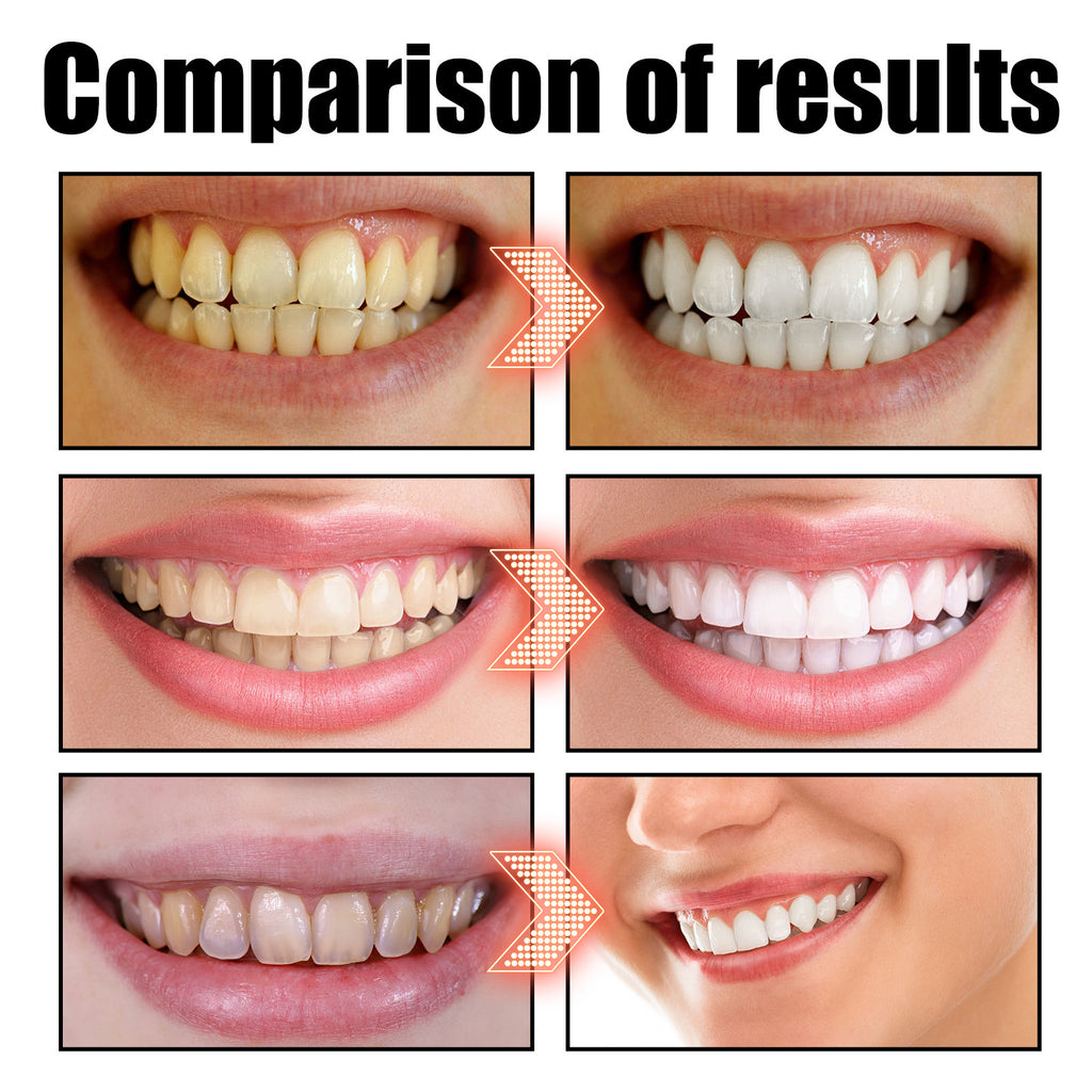 Coconut Oil Teeth Whitening Mouthwash