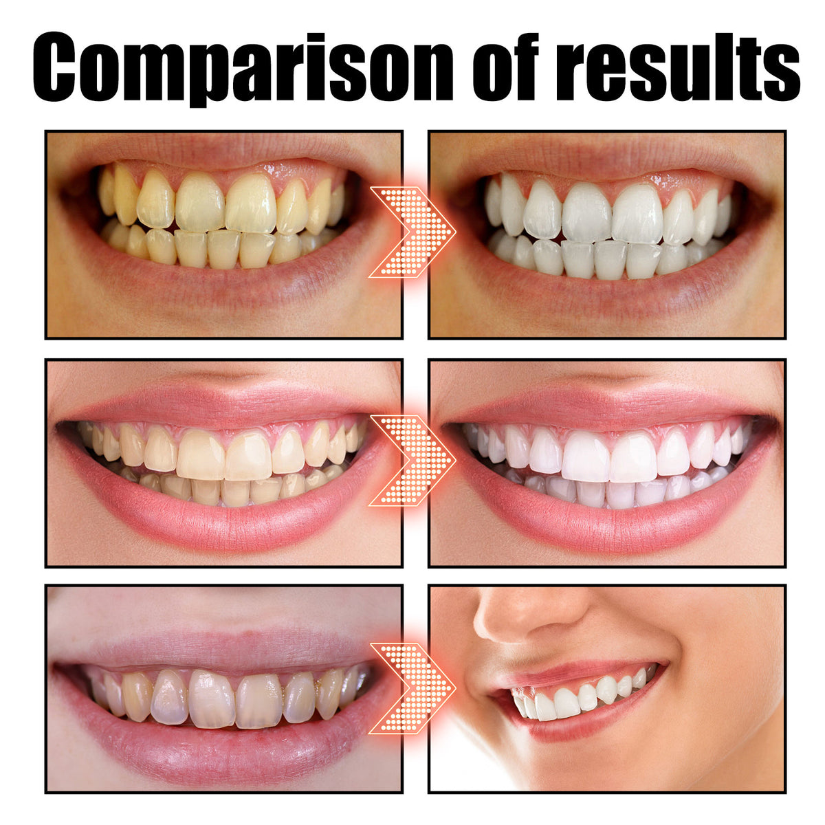 Coconut Oil Teeth Whitening Mouthwash